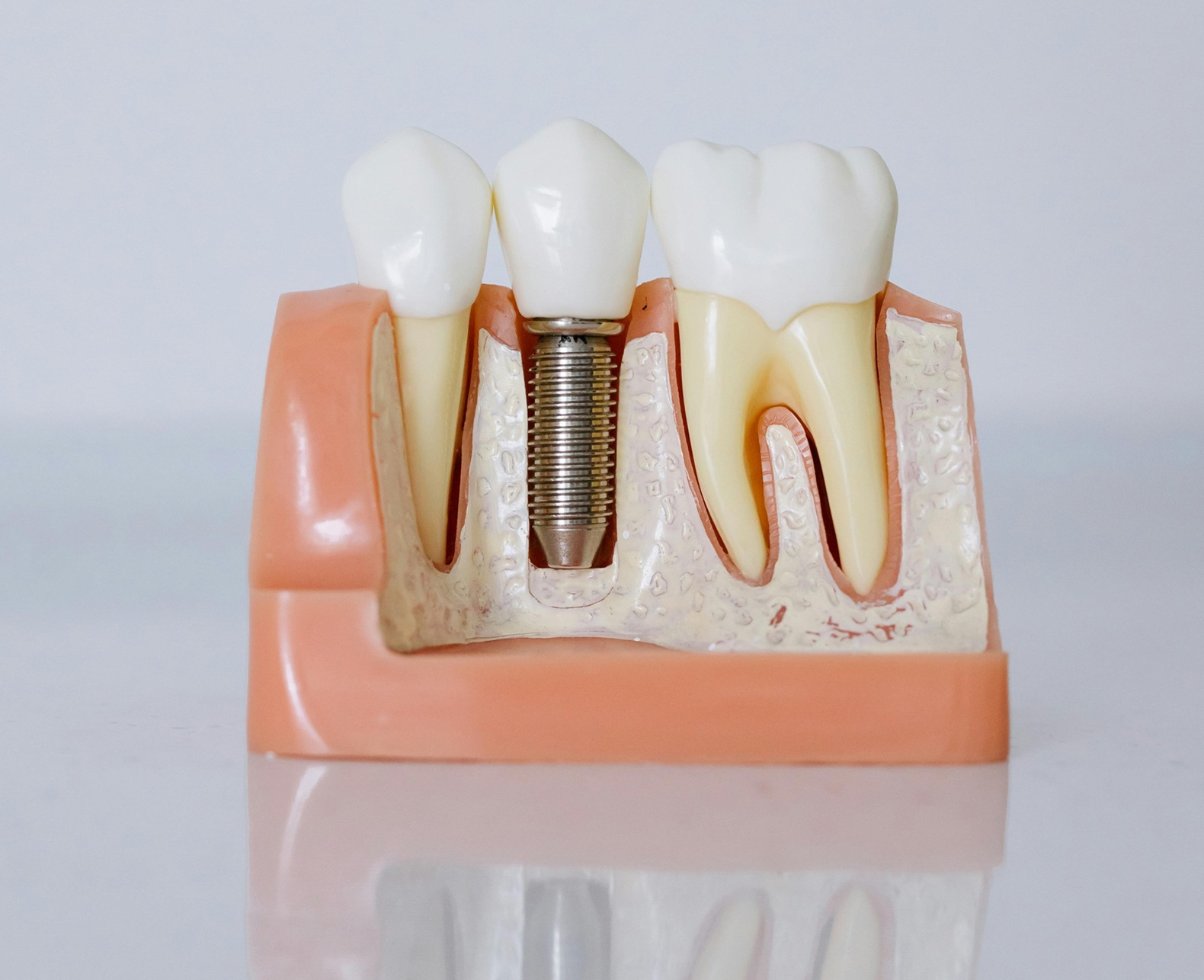 Dental