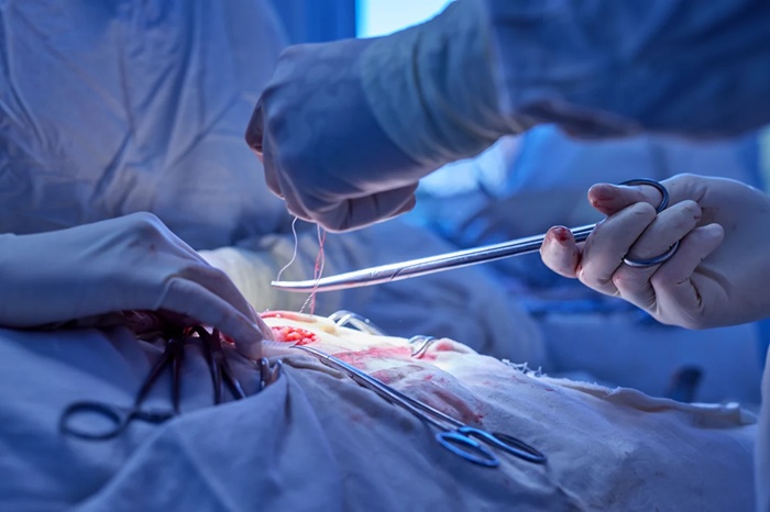 Vascular Surgery 