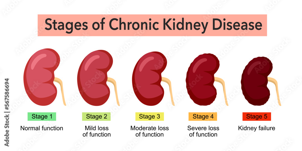 kidney 1