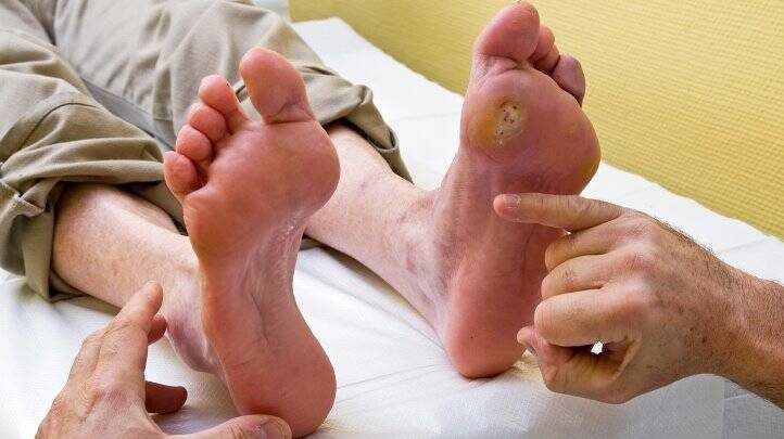 diabetic wound